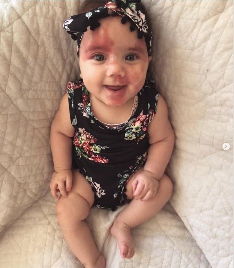 baby-with-a-cute-face