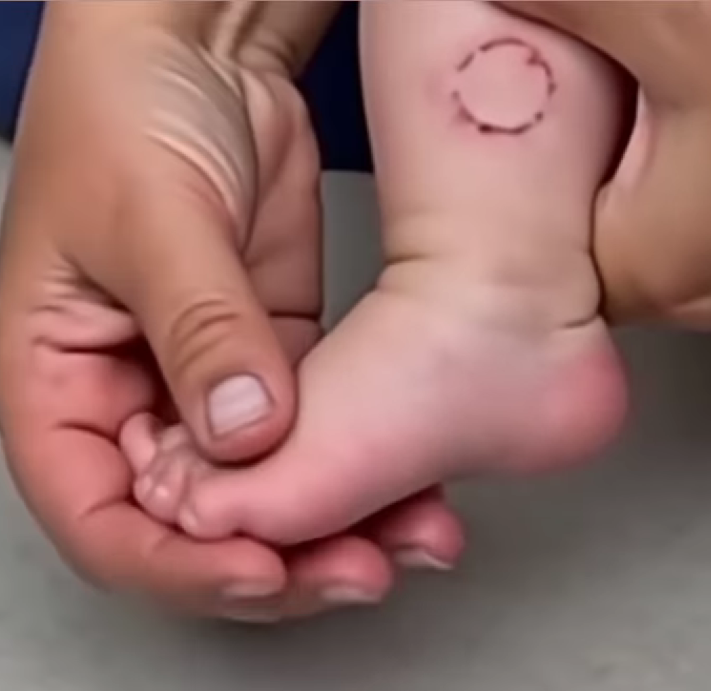 gyt