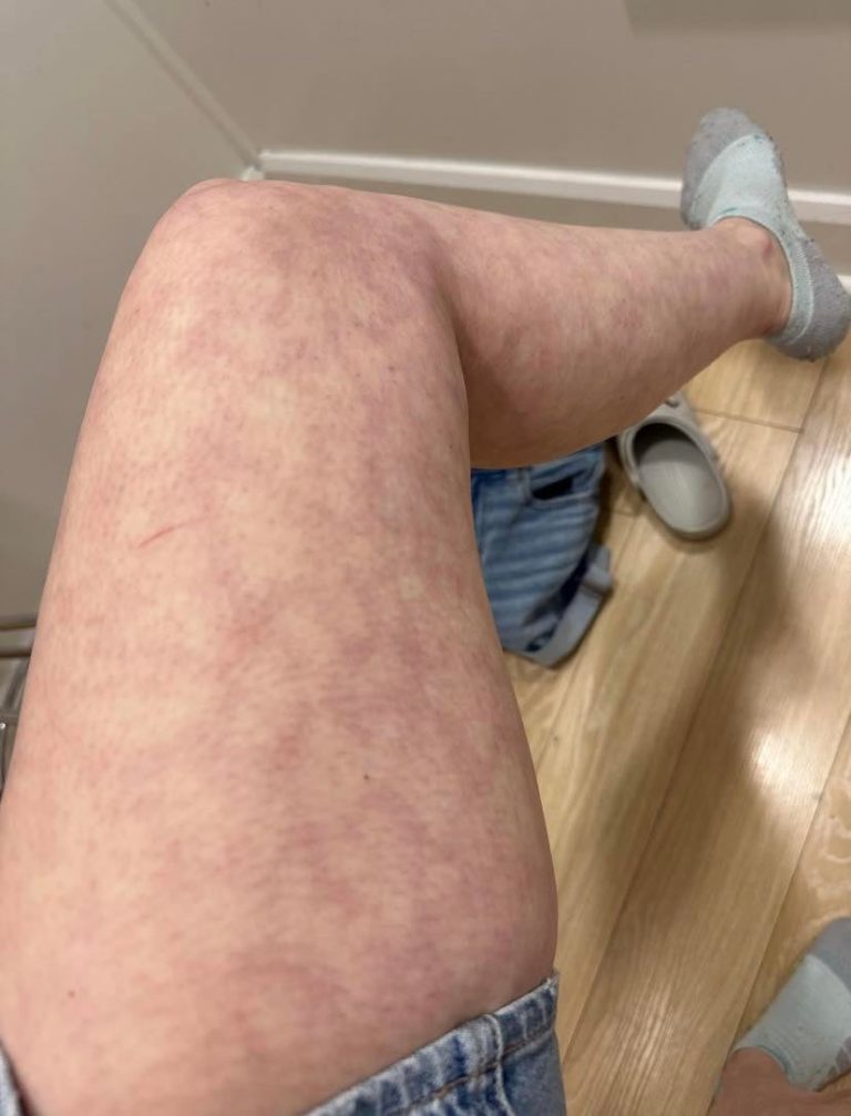 legnrm