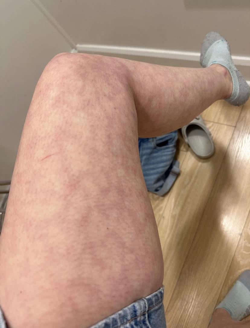 legnrm