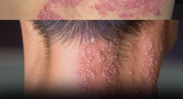 577764409_1176766911285347_5221777425859389592_n-735x400