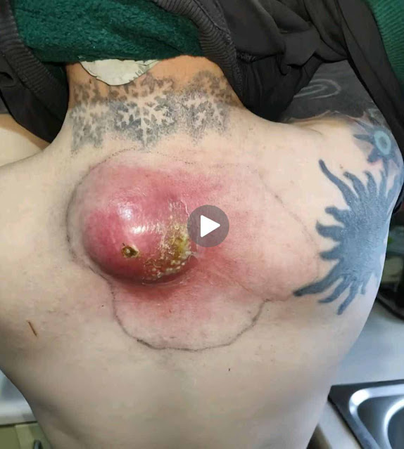 611345988_122208686720048389_4103283750750401264_n