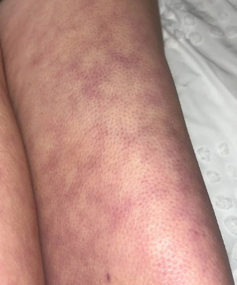 628084755_122267471114034369_2918462819509895783_n