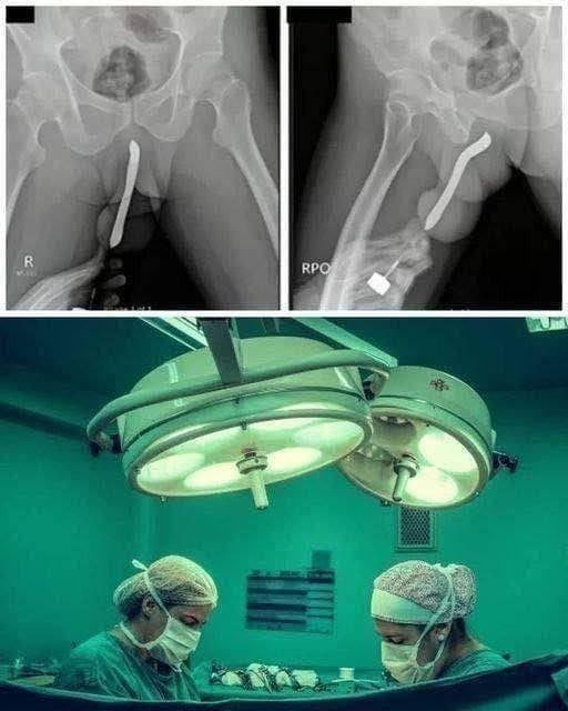 632053286_122267948702034369_1602002745596548689_n