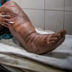 These are the consequences of sleeping with a... See more