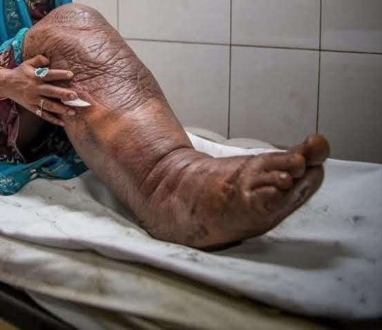 These are the consequences of sleeping with a... See more