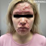 These are the consequences of sleeping with a... See more👇