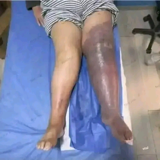 These are the consequences