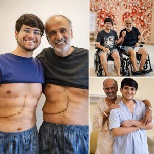 Son who donated part of his liver to his father unfortunately ends up fa… See more