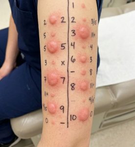 🚨 “I Noticed a Small Bump… Then I Realized How Common This Actually Is”