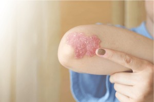 These are the consequences of sleeping with…See more