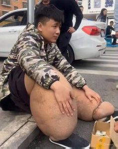 These are the consequences of sleeping with the… See more