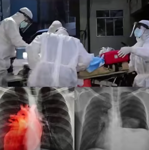 Hidden Biological Trigger Identified Why Some Experience Heart Inflammation After mRNA Vaccination
