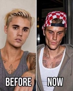 Justin Bieber Opens Up About a Personal Challenge and Shares an Important Message With Fans